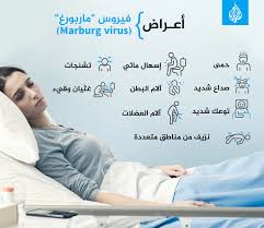 تصريحات تهم المصريين عن فيروس ماربورج رسالة طمأنة من وزارة الصحة مش موجود في مصر وهذه أعراضه 3 فيروس الماربورج