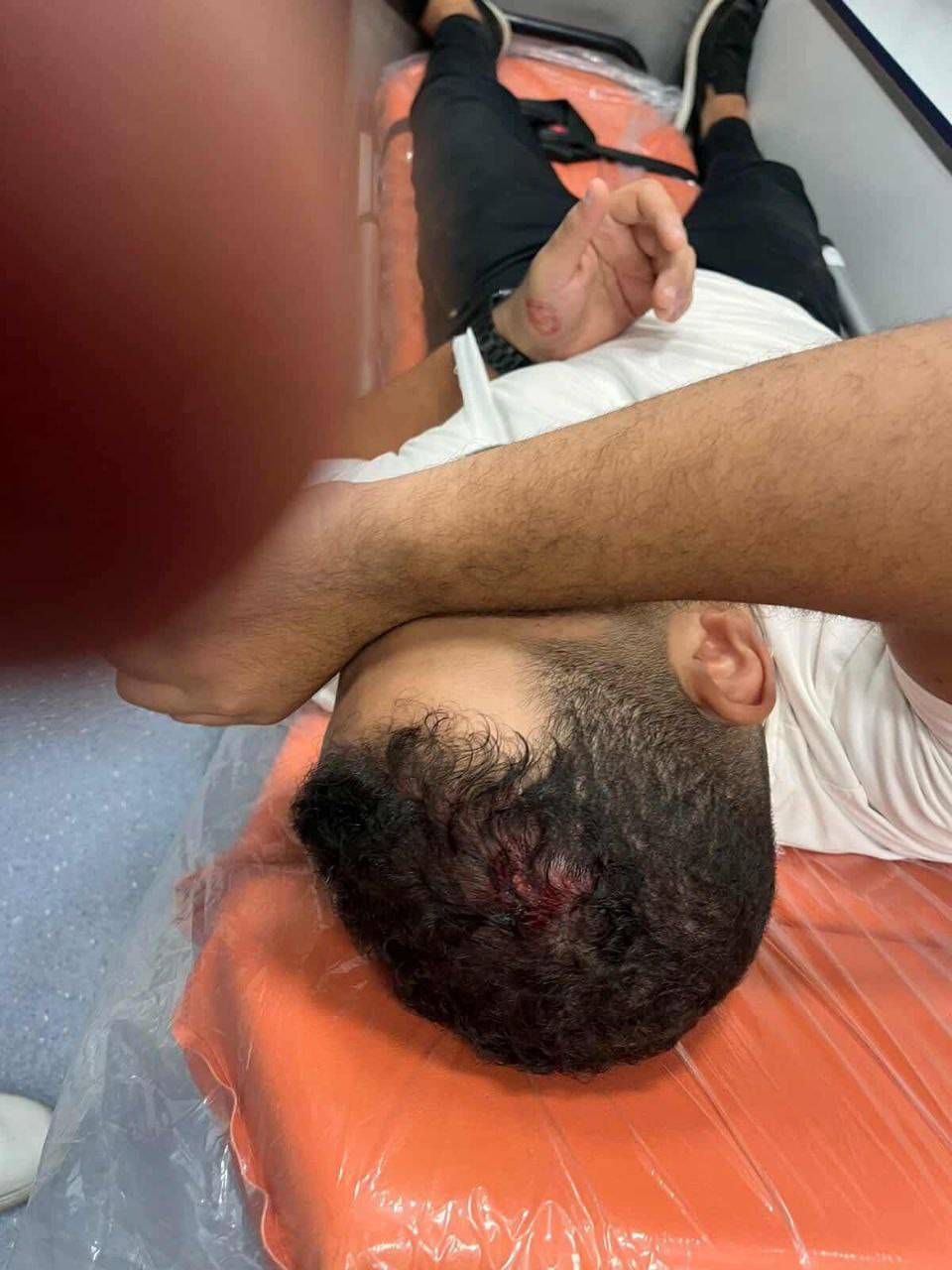 بالصور المواطن أنطون سيدهم يستغيث بوزارة الداخلية عقب تعرضه لاعتداء على الطريق الدائري بمسطرد 3 الاعتداء على أنطون سيدهم