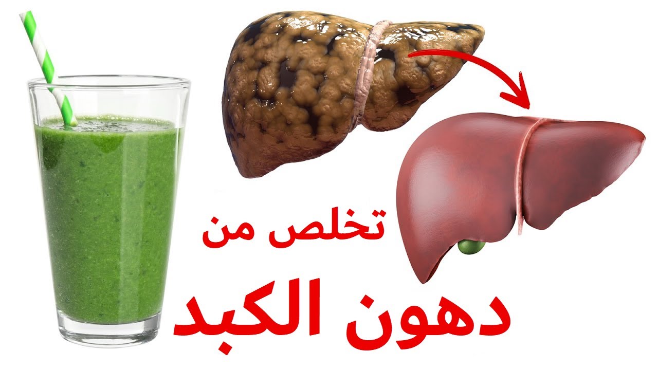 الكشف عن أسهل طريقة سريعة لـ تنظيف الكبد من الدهون 2 تنظيف الكبد من الدهون