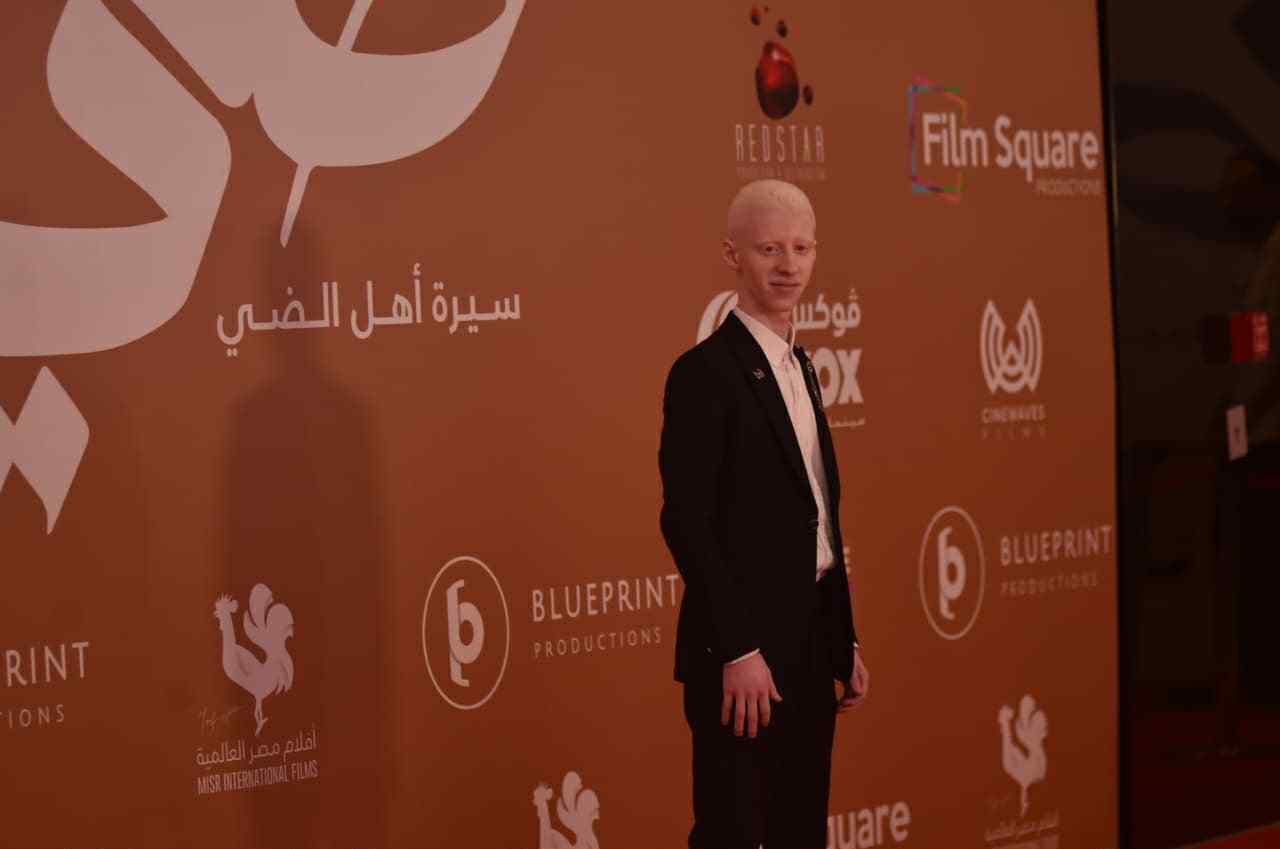 الفنان بدر محمد بطل فيلم ضي يصحح مصطلح خاطئ عن حالات الألبينو عدو الشمس 3 الفنان بدر محمد