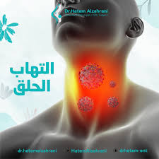 طرق علاج التهاب الحلق الفيروسي في المنزل بفعالية 2 علاج التهاب الحلق الفيروسي
