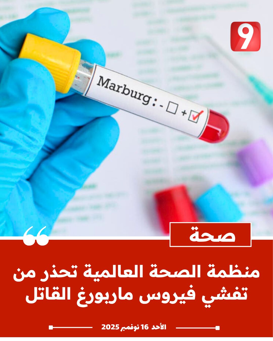 أعرف كل ما يخص فيروس ماربورغ عقب ظهوره في إثيوبيا ووفاة اشخاص 3 فيروس ماربورغ