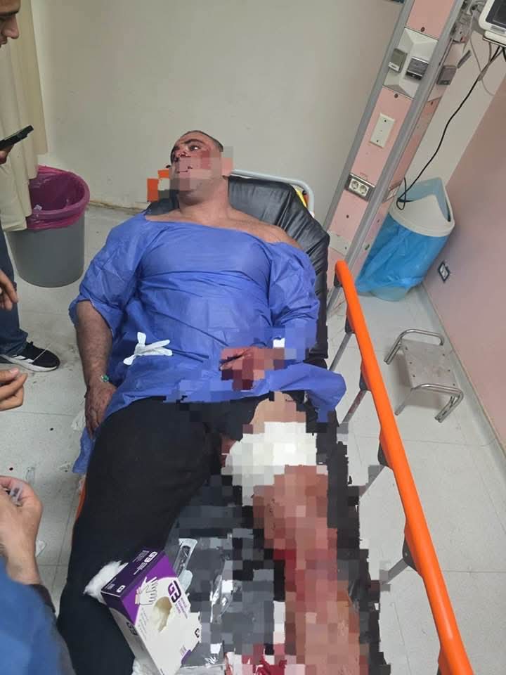 واقعة مدير جيم هزت الرأي العام شهادات شهود عيان على ضرب ديزل الشيخ زايد المتهم بودي جارد والضحية بطل جمهورية وأب لأربع أطفال 3 مدير جيم المجني عليه