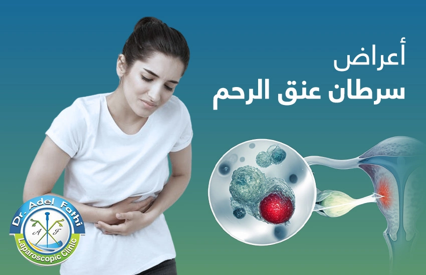 هؤلاء أكثر عرضة للإصابة بسرطان الرحم بعد وفاة الإعلامية نيفين القاضي 3 الإصابة بسرطان الرحم