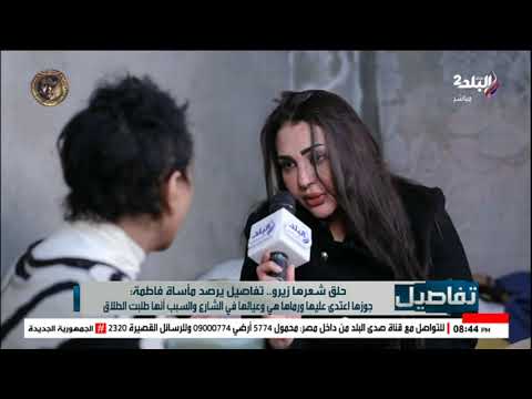 تحملت ما يفوق قدرة البشر فاطمة تروي تفاصيل مؤلمة عن تعرضها للعنف الزوجي حلق شعري وكان هيموتني 4 فاطمة ضحية العنف الزوجي