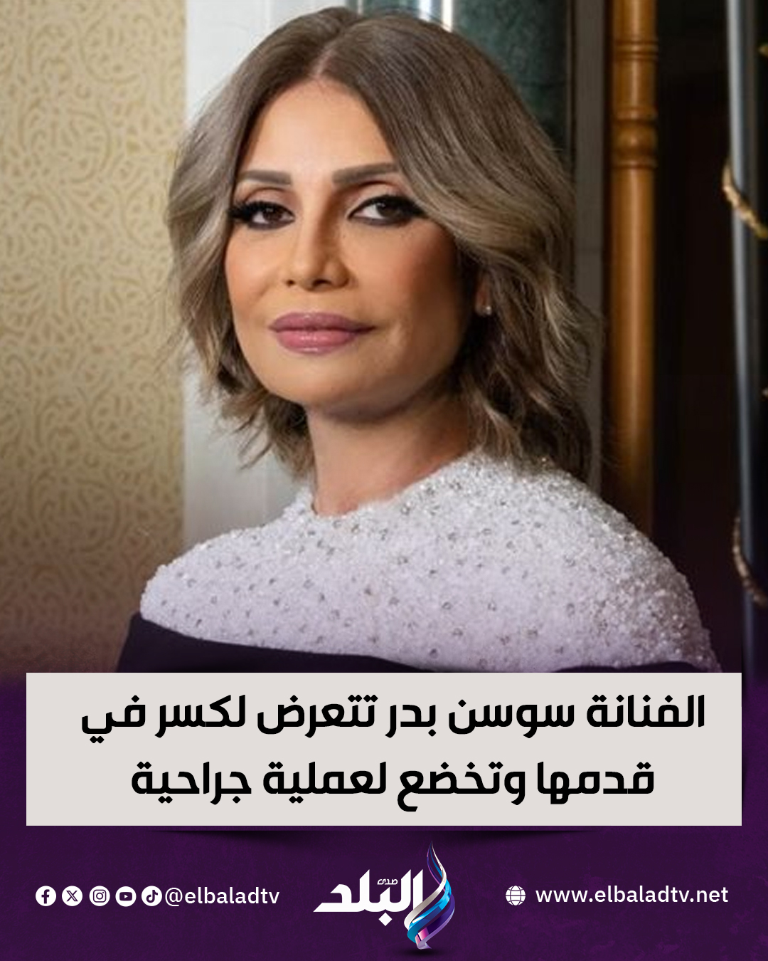 تفاصيل حالة الفنانة سوسن بدر بعد إصابتها بكسر في قدمها تحتاج شرائح ومسامير 2 حالة الفنانة سوسن بدر