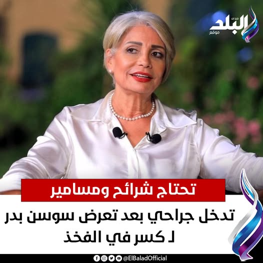 تفاصيل حالة الفنانة سوسن بدر بعد إصابتها بكسر في قدمها تحتاج شرائح ومسامير 3 حالة الفنانة سوسن بدر