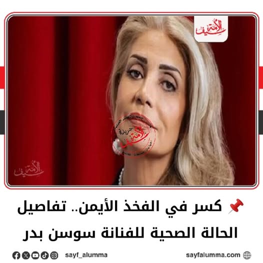 تفاصيل حالة الفنانة سوسن بدر بعد إصابتها بكسر في قدمها تحتاج شرائح ومسامير 4 حالة الفنانة سوسن بدر