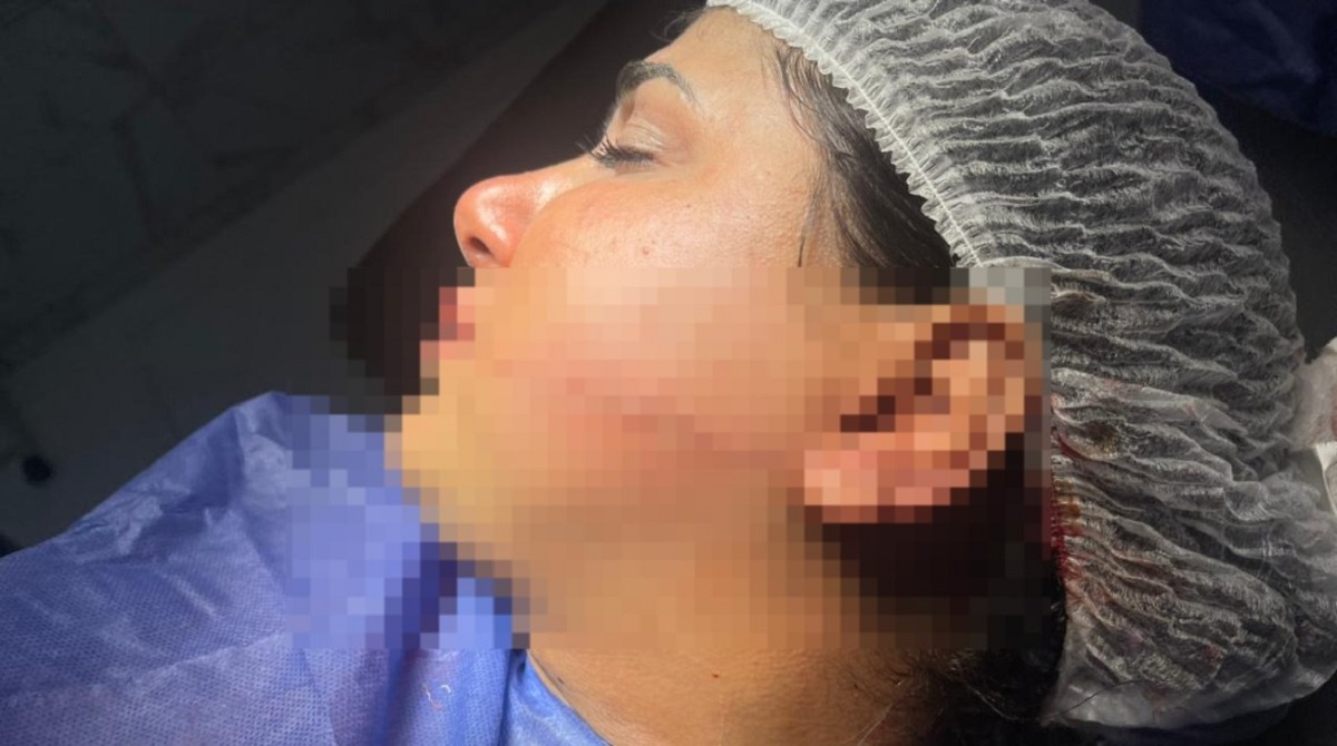 تعليق سمر ضحية الاعتداء من خطيبها ياريته قتلني ومشوهش وشي 4 سمر ضحية الاعتداء من خطيبها