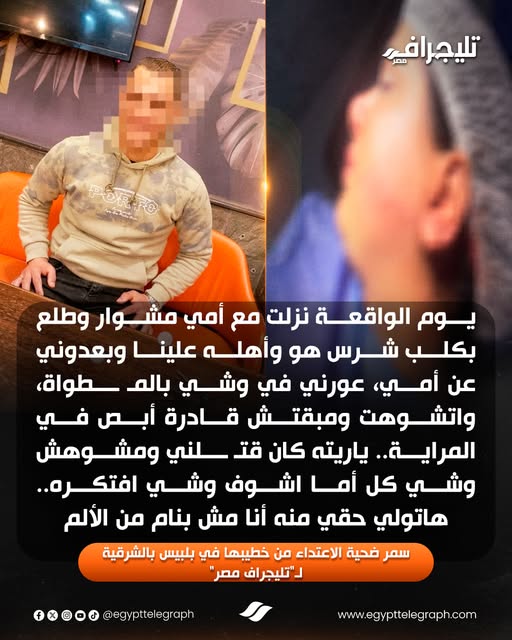 تعليق سمر ضحية الاعتداء من خطيبها ياريته قتلني ومشوهش وشي 3 سمر ضحية الاعتداء من خطيبها