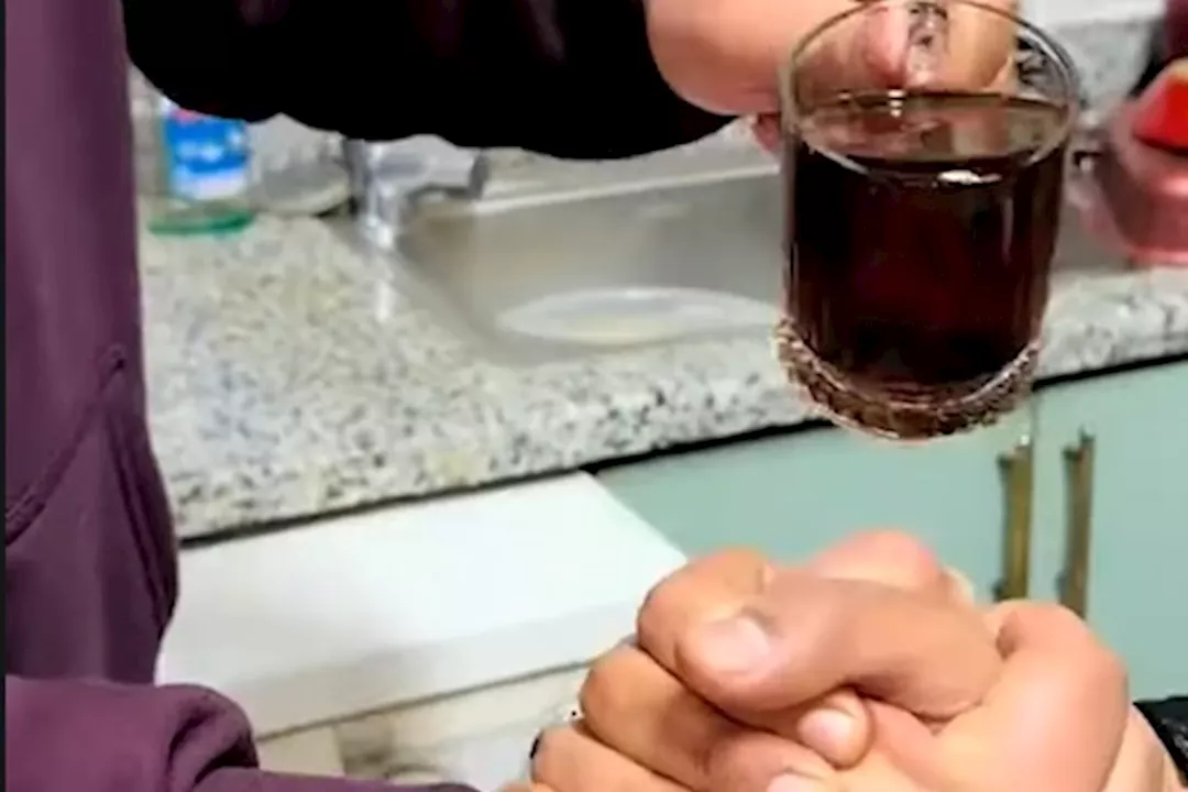 حروق وتشوهات كيف يهدد تحدي الشاي المغلي حياة المراهقين 6 تحدي الشاي