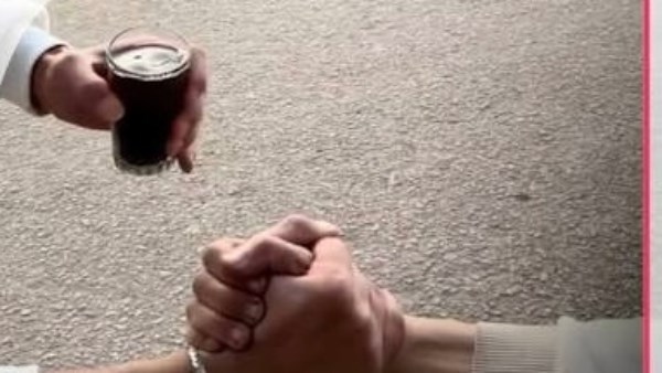 حروق وتشوهات كيف يهدد تحدي الشاي المغلي حياة المراهقين 5 تحدي الشاي1