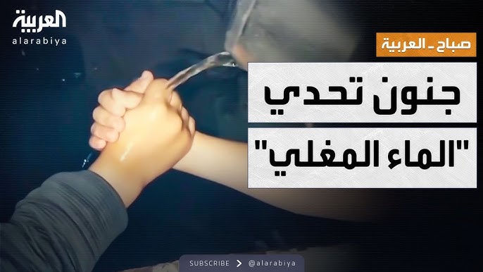 حروق وتشوهات كيف يهدد تحدي الشاي المغلي حياة المراهقين 2 تحدي الشاي4