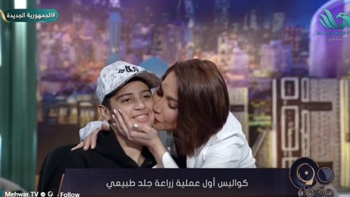 صاحب أول عملية زراعة جلد يعلن كواليس رحلته مع العلاج 80 يوما في الرعاية المركزة 4 صاحب أول عملية زراعة جلد