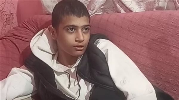 صاحب أول عملية زراعة جلد يعلن كواليس رحلته مع العلاج 80 يوما في الرعاية المركزة 3 صاحب أول عملية زراعة جلد