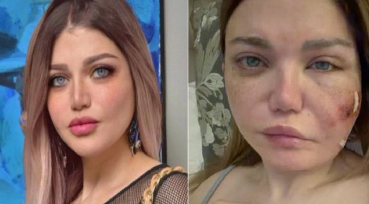 معلومات عن المرض الذي أصاب ياسمين الخطيب إليك تفاصيل توضيح الأطباء 4 ياسمين الخطيب تعلن إصابتها بعدوى بكتيرية