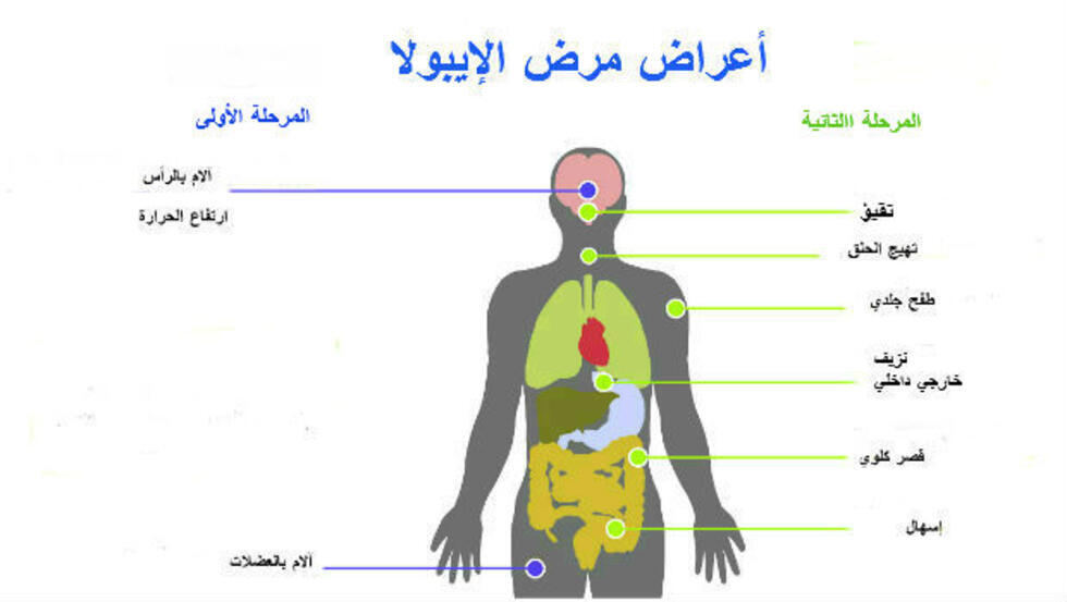 منظمة الصحة العالمية تعلن الطوارئ الدولية بسبب الايبولا وتصرح وباء بلا علاج 3 الطوارئ الدولية بسبب الايبولا