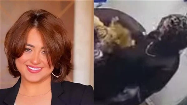 آخر مستجدات حالة الفنانة مروة عبد المنعم الصحية بعد تعرضها لهجوم شبل أسد عليها 3 حالة الفنانة مروة عبد المنعم