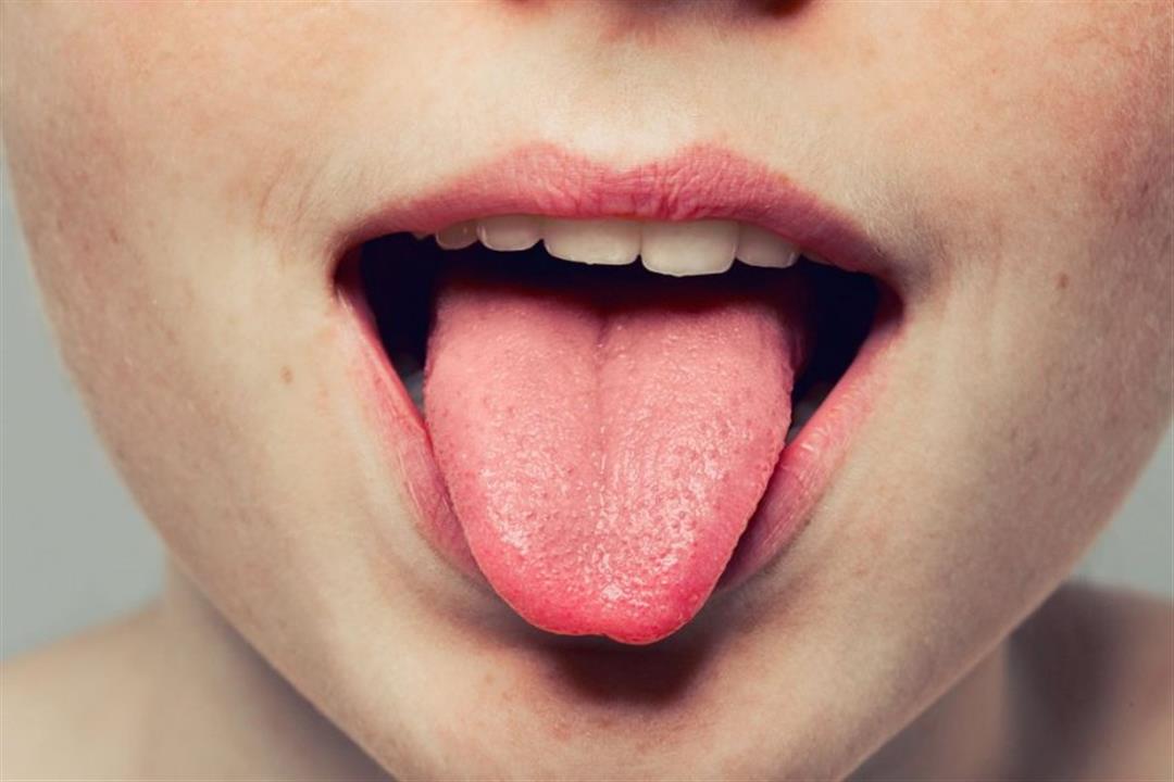 احذر قبل فوات الأوان علامات في اللسان تدل على الإصابة بأمراض خطيرة 3 2020 7 23 21 6 56 362