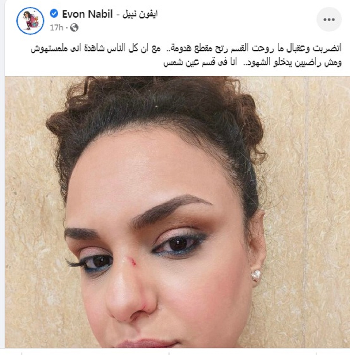 شاهد ما حدث لـ إيفون نبيل من طليقها خلال حكم الرؤية 2 331121826 777955360593699 258980905716533898 n 16 350x350 87