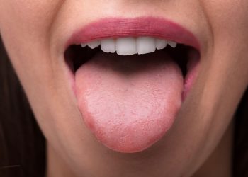 احذر قبل فوات الأوان علامات في اللسان تدل على الإصابة بأمراض خطيرة