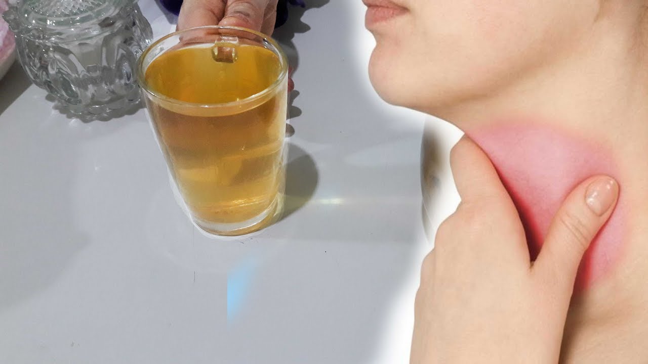 علاج السعال الجاف بـ 3 وصفات منزليه 2 علاج السعال الجاف