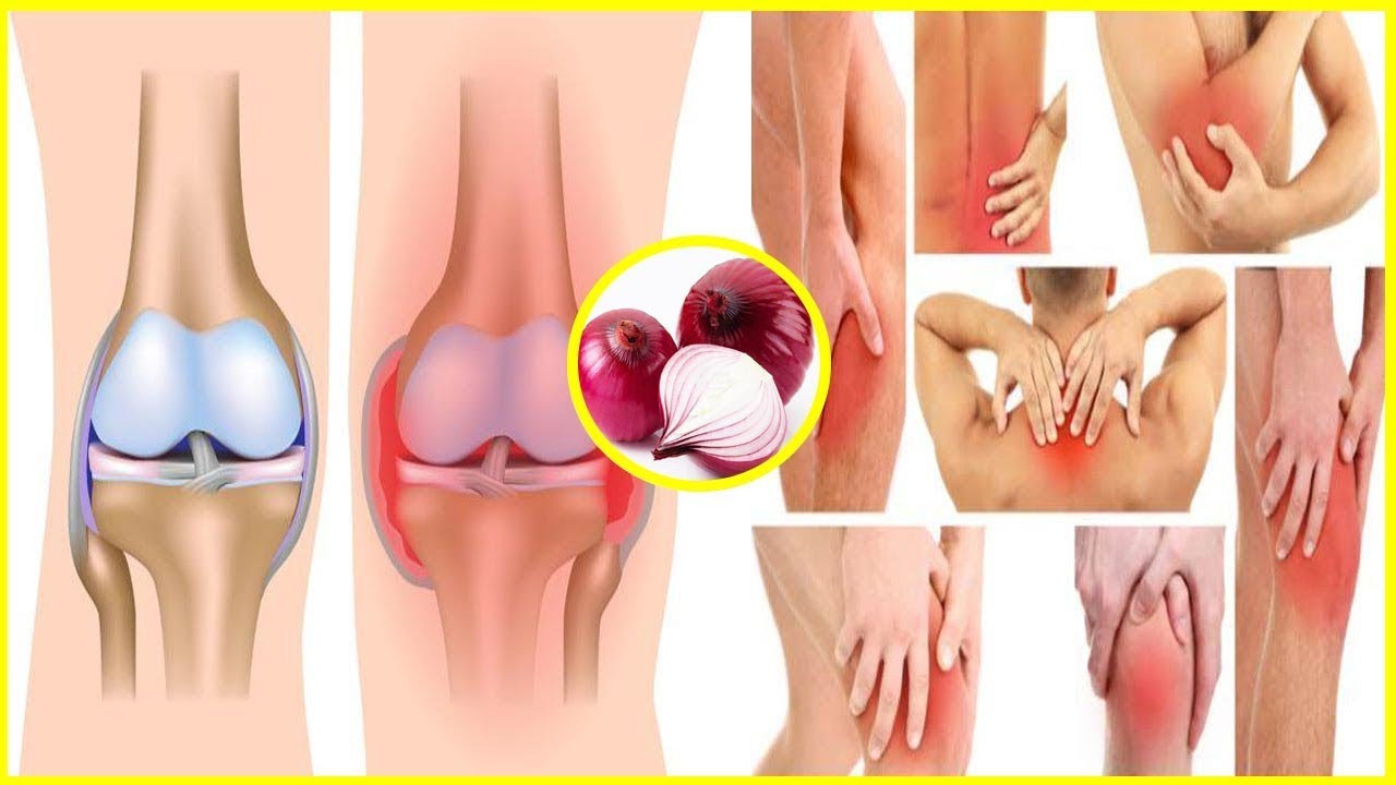  علاجات منزلية طبيعية لألم الركبة 