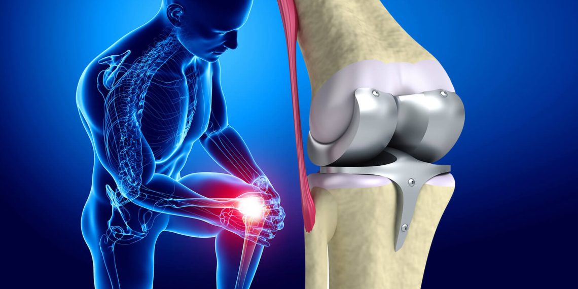علاجات منزلية طبيعية لألم الركبة