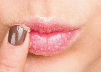 وصفات لعلاج الشفاة المتشققة 2023