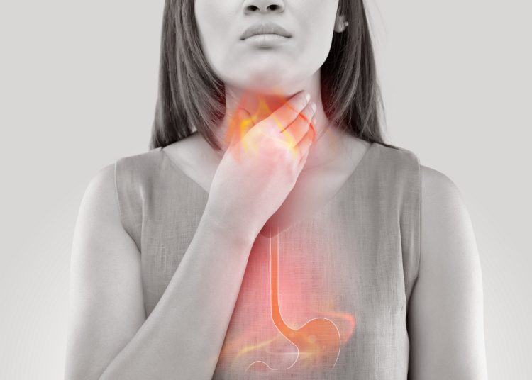 مفاجأة كيف تعالج الحموضة بـ3 طرق سحرية 1 أطعمة تسبب الحموضة احذر من أكلها