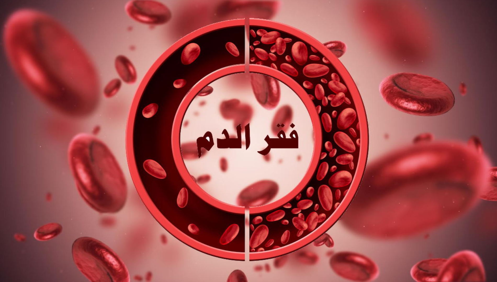 تعرف على الأنواع الرئيسية للأنيميا وأشهرها 2 الأنواع الرئيسية للأنيميا