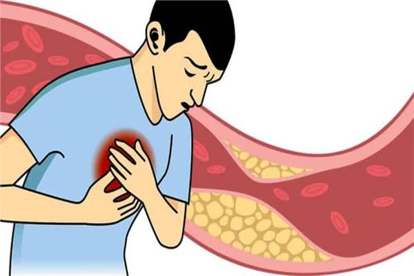نبته تحارب الكوليسترول ولها فوائد صحية متعددة 3 الوقاية من تصلب الشرايين