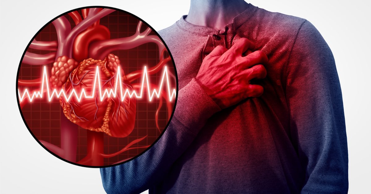 علامات الإصابة بالنوبة القلبية