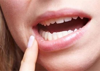 سرطان الفم احذر  هذه الأعراض و العلامات المبكرة
