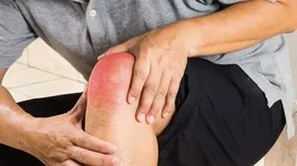 علاج ألام الركبة بالطعام الطب البديل 2023 4 علاج ألام الركبة بالطعام