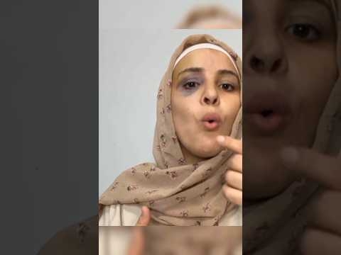 حكاية جبس مصر ترند قلب السوشيال ميديا 1 حكاية جبس مصر
