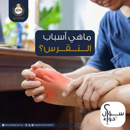 مرض النقرس هؤلاء الأشخاص الأكثر المعرضين للإصابة 2 أسباب مرض النقرس