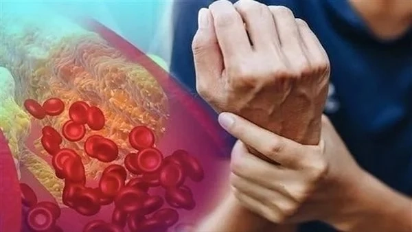 خلي بالك من علامات ارتفاع الكوليسترول هذا مؤشر الخطر 1 ارتفاع الكوليسترول