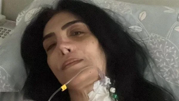 تفاصيل عملية حورية فرعلي من داخل غرفة العمليات 2 الحالة الصحية لحورية فرغلي