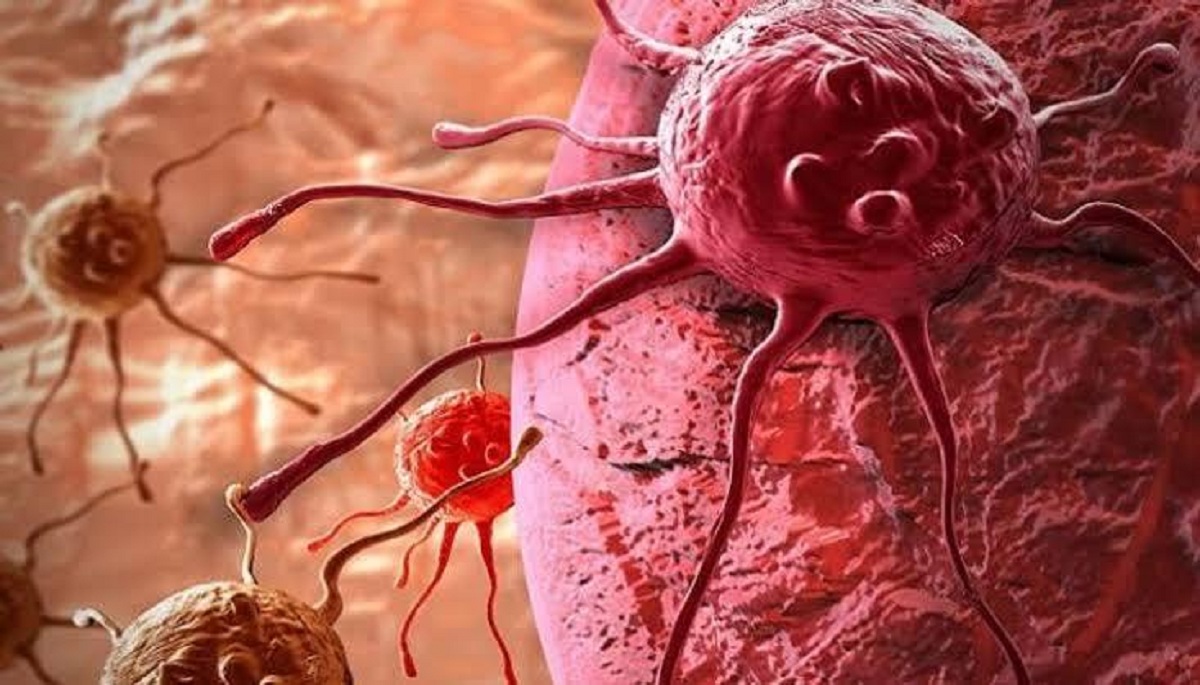 تدل على السرطان لو ظهرت علامات في مناطق معينة بالجسم 4 علامات تدل على السرطان