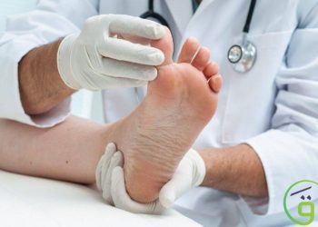 علاج عين السمكة والكالو