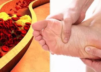 أعرف أعراض ارتفاع الضغط والكوليسترول 8 علامات تظهر على القدم