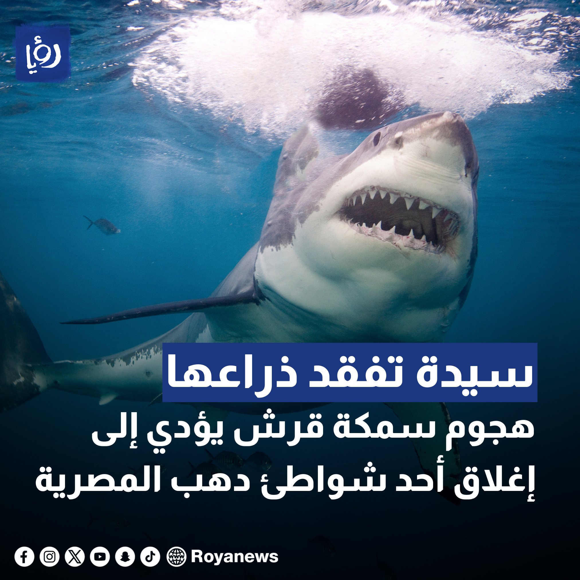 تعرض سيددة مصرية لهجوم سمكة القرش