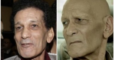 بعد معاناة الفنان محمد فريد من هذا المرض أحذر تناول هذه الأطعمة 3 مرض الفنان محمد فريد