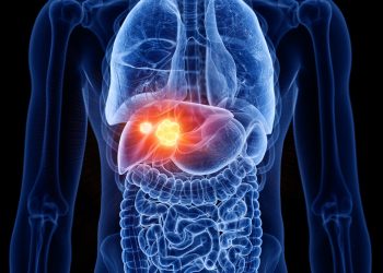 الفرق بين أعراض سرطان الكبد وعسر الهضم