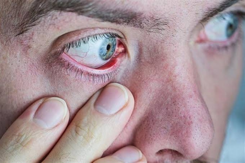 احذر أمراض خطيرة ترتبط بحركة رمش العين