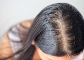 للتخلص من فراغات الشعر و الهالات السوداء وصفات طبيعية على طريقة رضوى الشربيني