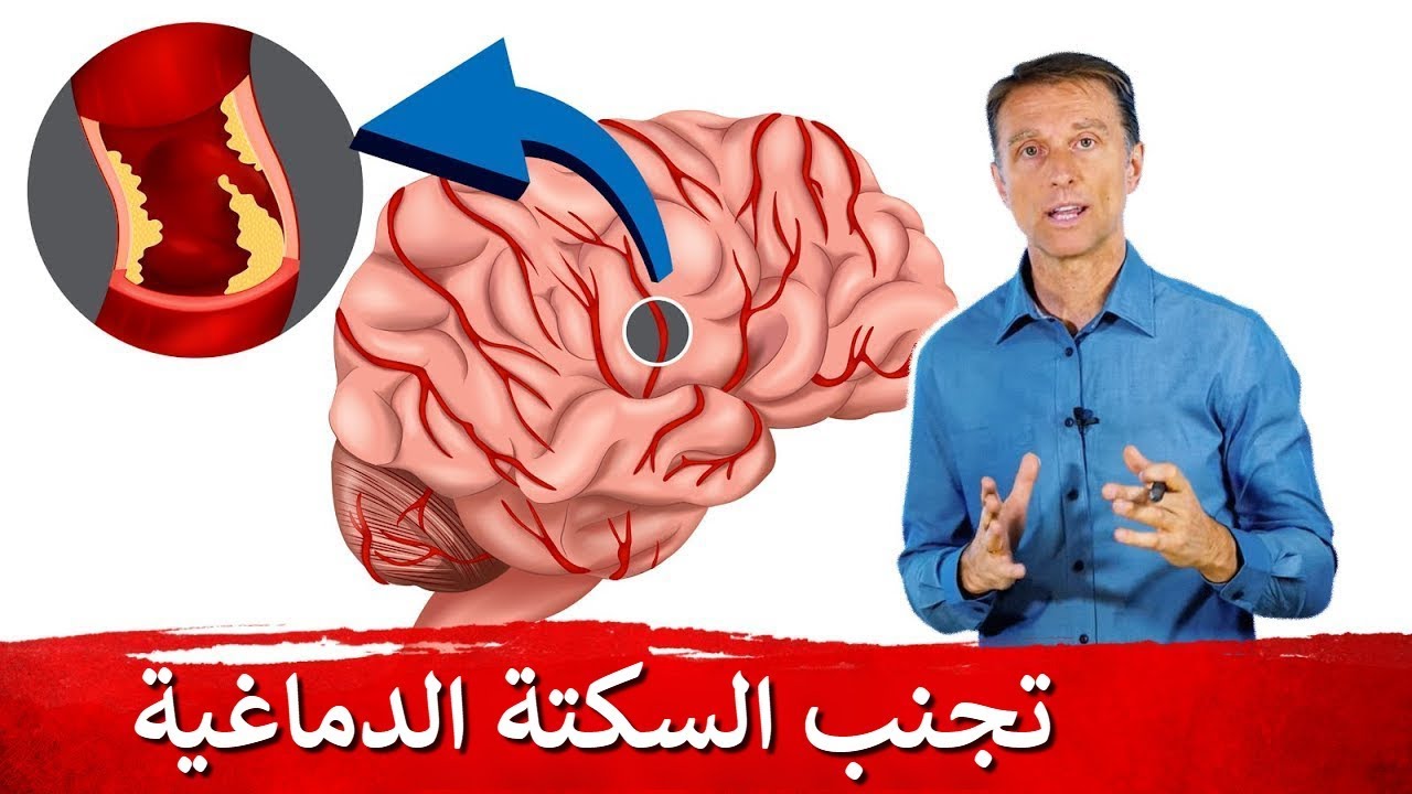 تدل على إصابة بسكتة دماغية احذر من هذه العلامات لاحظ طريقة مشيك 2 علامات إصابة بسكتة دماغية