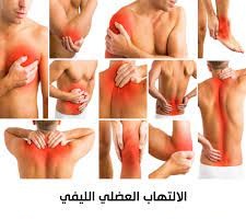 مرض الألم العضلي الليفي ما هو وما أعراضه وطرق علاجه 2 مرض الألم العضلي الليفي
