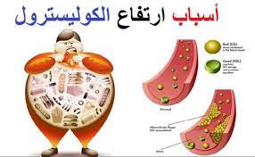 احذر ارتفاع الكولسترول في هذه الحالة يتحول إلى مرض مميت 3 احذر ارتفاع الكولسترول
